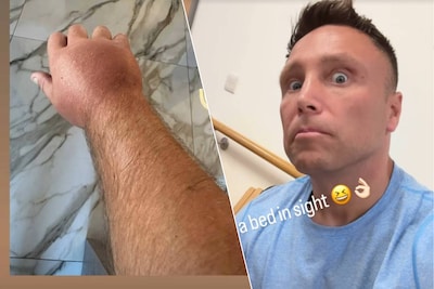 “Net wat ik niet wilde”: moet Gerwyn Price door opgezwollen hand verstek geven voor toernooi in Antwerpen?