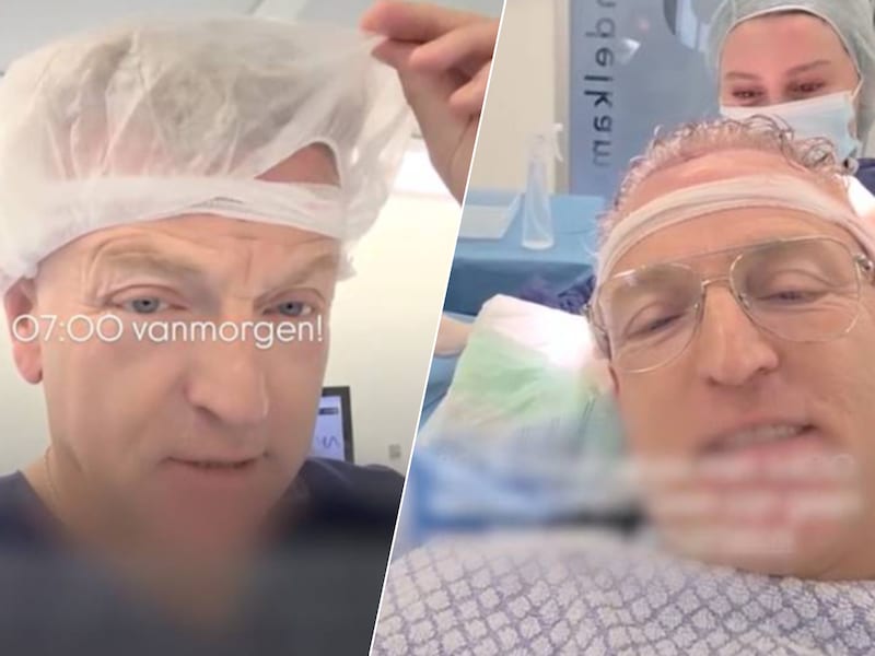 Gordon ondergaat haartransplantatie. 