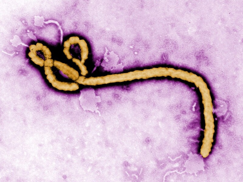 Het Ebolavirus.