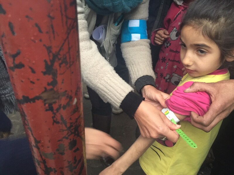 Ondervoed meisje in de belegerde Syrische stad Madaya.