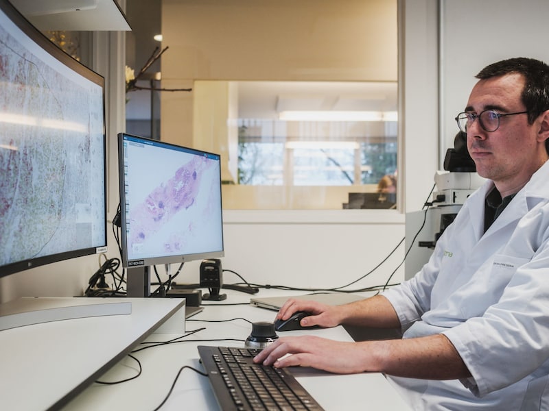Vier Belgische borstklinieken testen als eerste AI-ondersteuning bij behandeling borstkanker: “Drie cruciale voorspellingen bij diagnose”