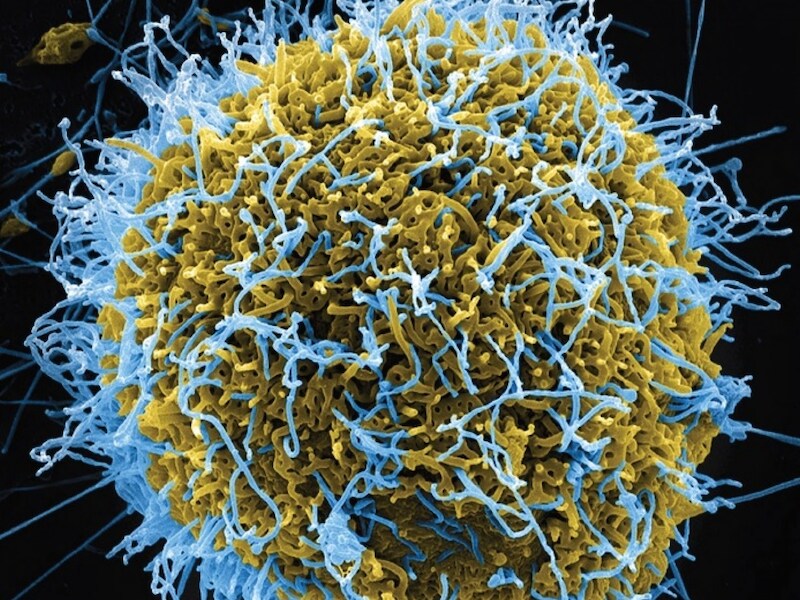 Scan van het ebolavirus uit een geïnfecteerde cel.
