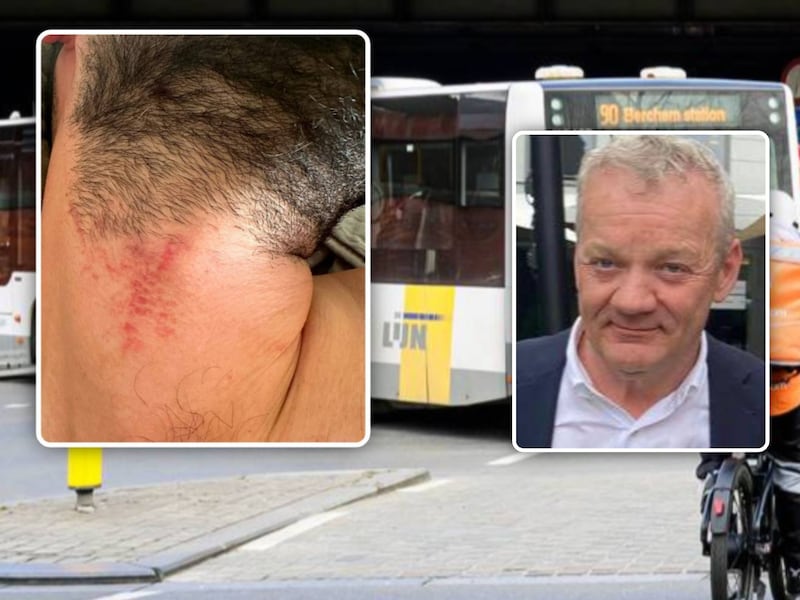 Vier busreizigers proberen controleur van De Lijn te wurgen in Berchem, vakbond reageert fors: “Dit is een poging tot moord”