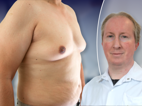 Dr. Joeri Pen (UZ Brussel) legt uit waar manboobs vandaan komen en hoe je ervan af raakt.