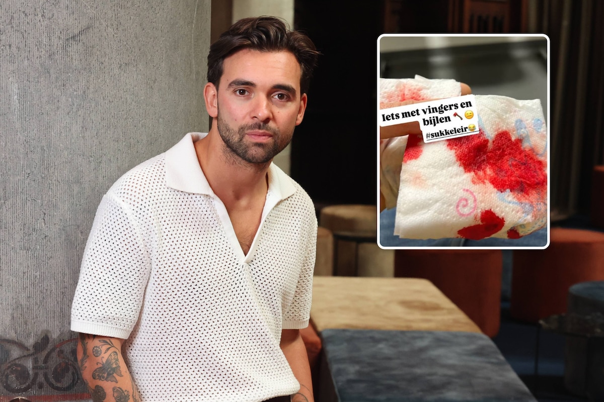 Bijna duim kwijt: voormalig 'Thuis'-acteur Mathias Vergels heeft ongeluk  met bijl | BV | HLN.be