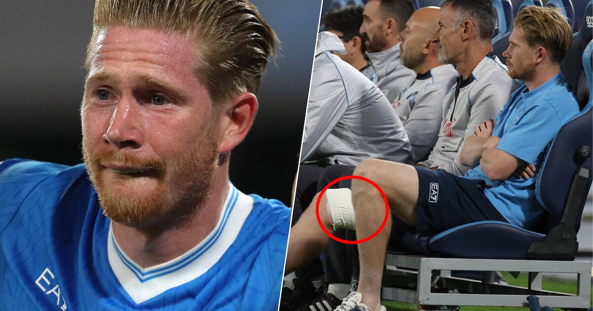 “Ernstige scheur”: Kevin De Bruyne kent verdict na scans en staat weken ...
