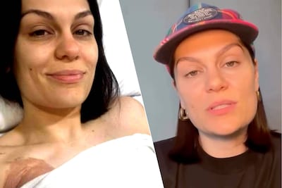 Jessie J stelt Europese tournee uit: zangeres moet opnieuw onder het mes