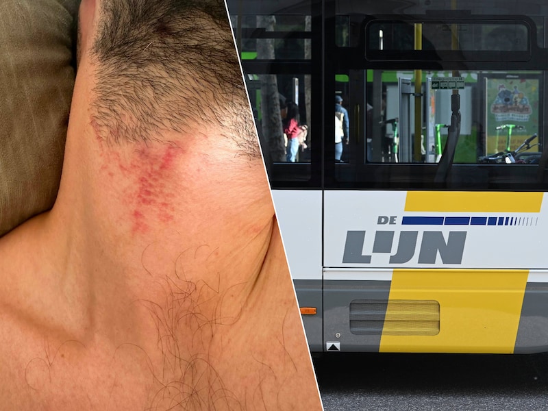 Vier busreizigers proberen controleur van De Lijn te wurgen in Berchem, vakbond reageert fors: “Dit is een poging tot moord”