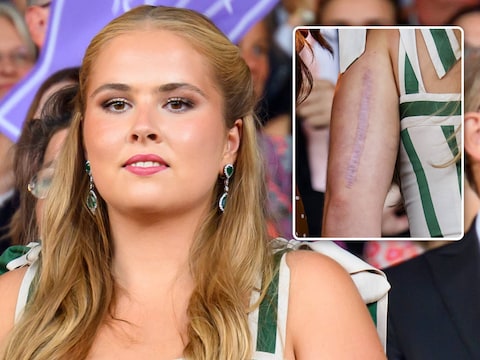 Prinses Amalia toont in Aken litteken van eerdere val van paard