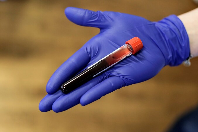 Landelijke bloedtest om te zien of in Nederland immuniteit tegen corona ...