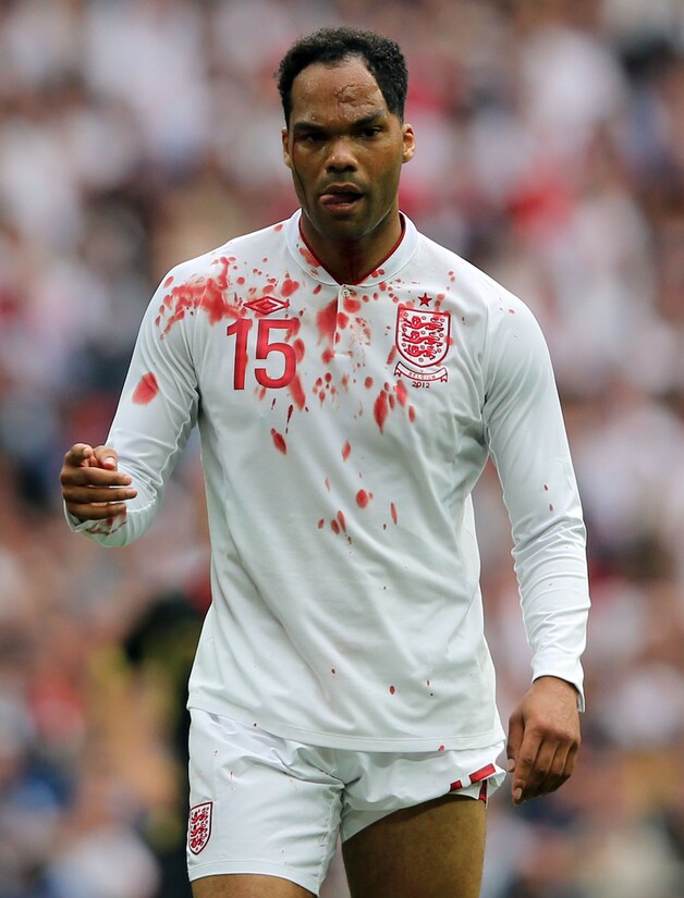 Een bebloede Lescott hield met Engeland de nul.