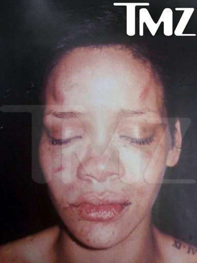 De foto's van een bont en blauw geslagen Rihanna gingen toen de wereld rond.