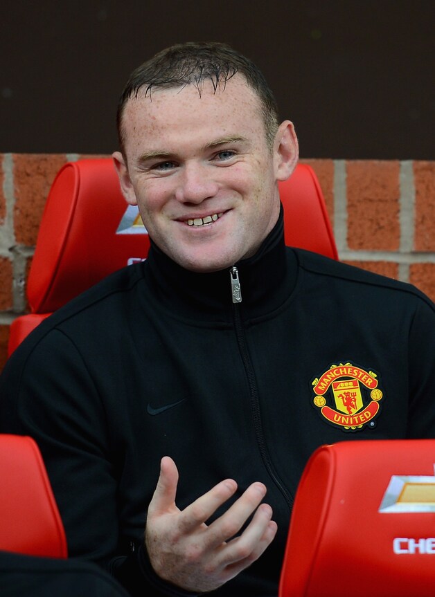 Wayne Rooney spendeerde een fortuin aan een haartransplantatie.