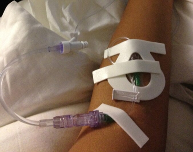 Na enkele verontrustende Tweets van haar fans, postte Rihanna deze foto van haar arm aan een infuus op Twitter. © Twitter