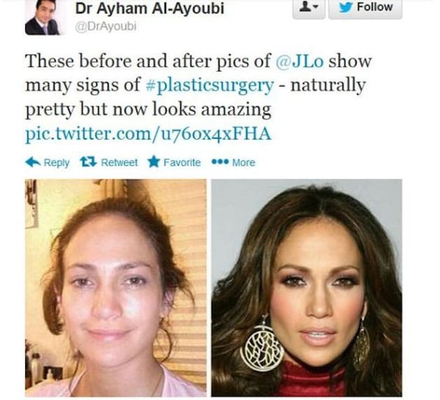 Screenshot van de gewraakte, inmiddels gewiste tweet van de Londense plastisch chirurg Ayham Al-Ayoubi.