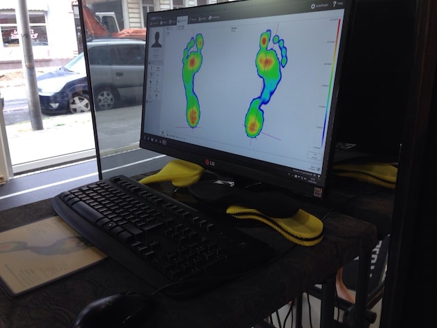 Het resultaat van de footscan.