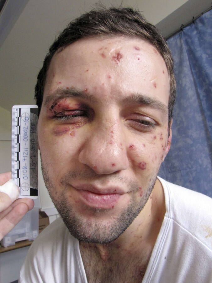 Lors Doukaev. (Foto uit 2010).
