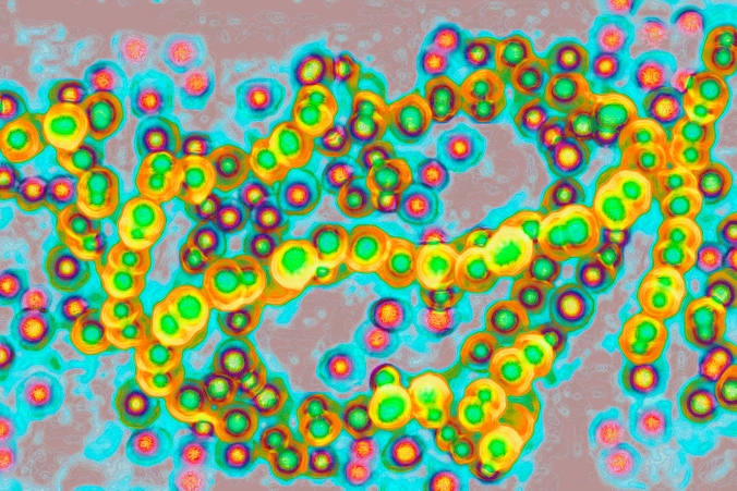 TSS wordt onder meer veroorzaakt door streptococcus pyogenes, een Groep-A-streptokok, die ook ‘vleesetende bacterie’ wordt genoemd.