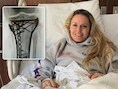 Na dramatische val op Winterspelen blijft lijdensweg duren: skilegende Lindsey Vonn moest nog eens zes uur onder het mes