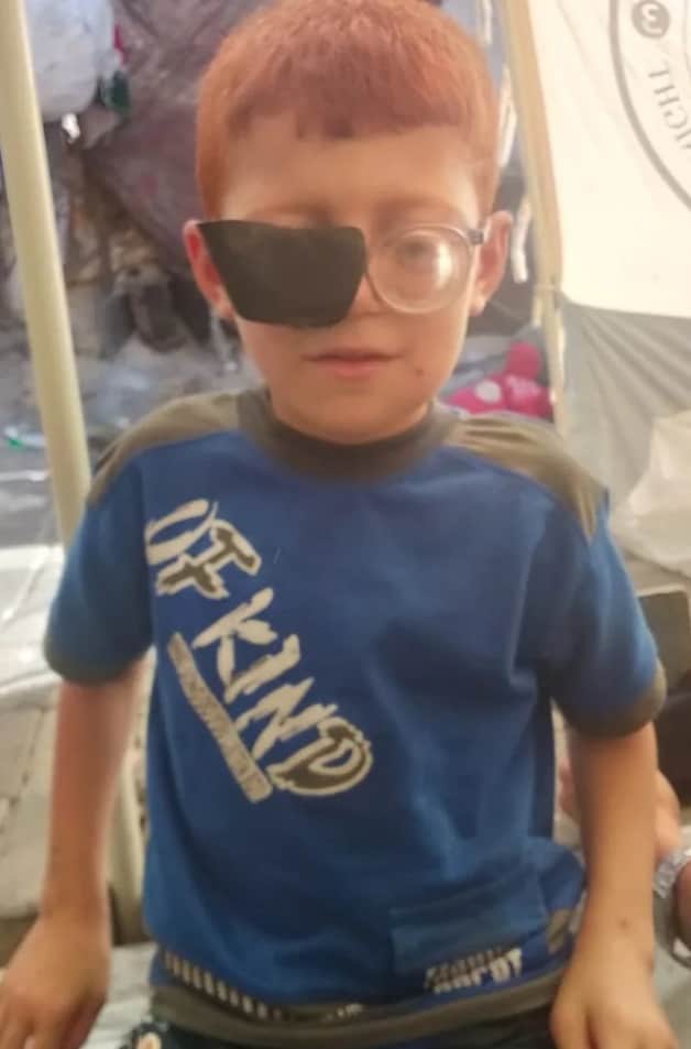 Ayoub Junaid zijn oogproblems that have not yet been solved, heeft an operation nodig as a result of his mother