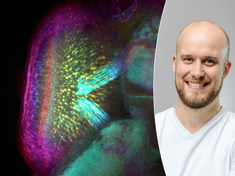 Dit microscoopfotootje van 0,3 millimeter kan de sleutel zijn tot het herstellen van blindheid