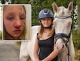 Paard schrikt door luide sportwagen en zet been vol in gezicht van Lucie (12): “Net toen hij hen passeerde, duwde die idioot het gaspedaal in”