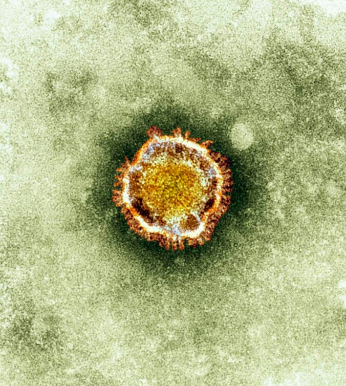 Het Coronavirus onder de microscoop.