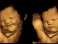 
Smaak van boerenkool doet ongeboren baby’s grimassen trekken