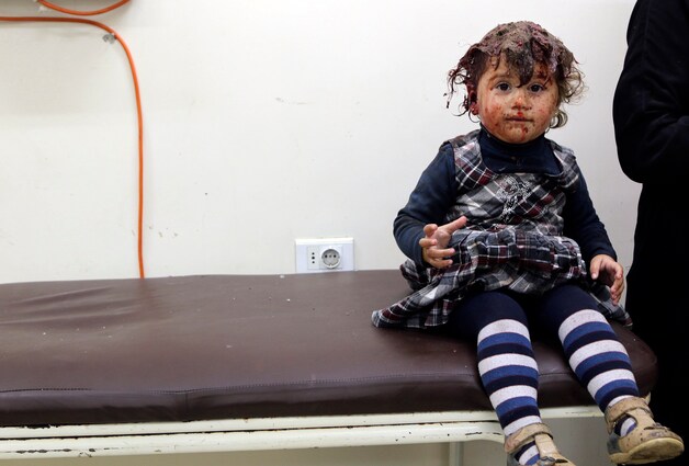 Een meisje is gewond geraakt door een vatenbom in het al-Sakhour district in Aleppo.