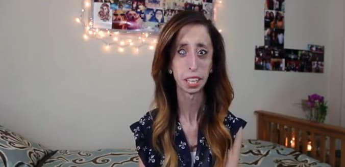 Lizzie Velasquez