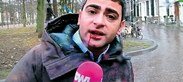 Danny Ghosen is een tand kwijt en moest naar het ziekenhuis.