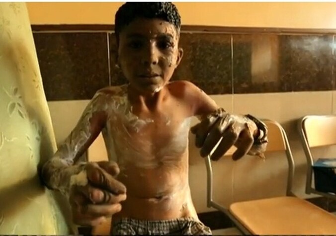 Een screenshot van de BBC-beelden na een brandbom op een Syrische speelplaats.