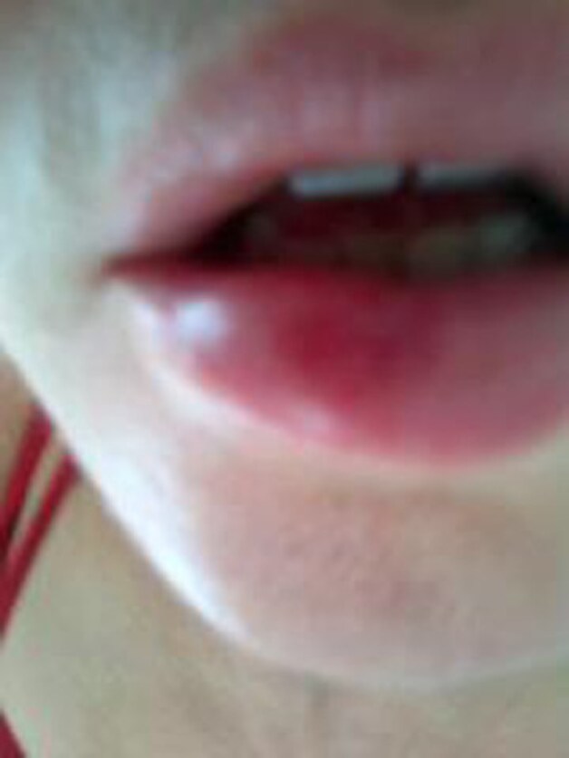 De foto van haar lip die Madonna op Facebook zette.