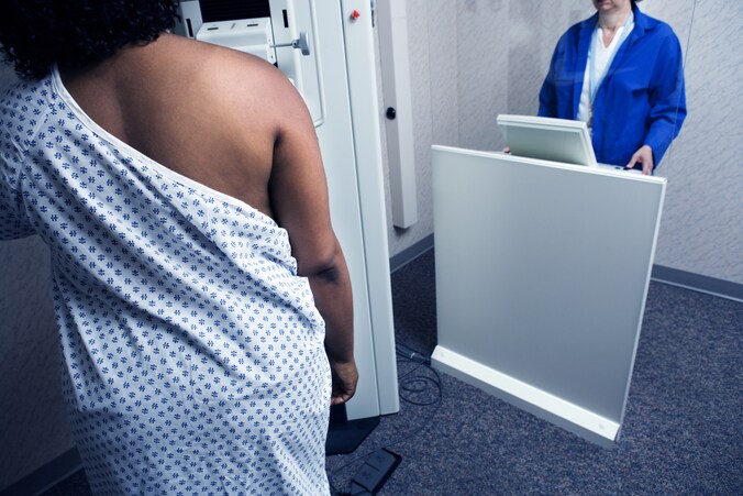 Vrouw ondergaat een mammogram.