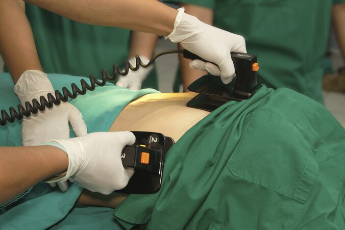 Een defibrillator in actie