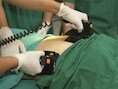 Een defibrillator in actie