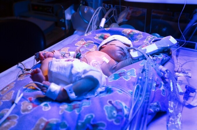 Vroeggeboorte leidt tot redelijk wat gezondheidsproblemen.