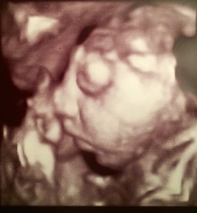 Een foto van de 4D-echo van Shane.