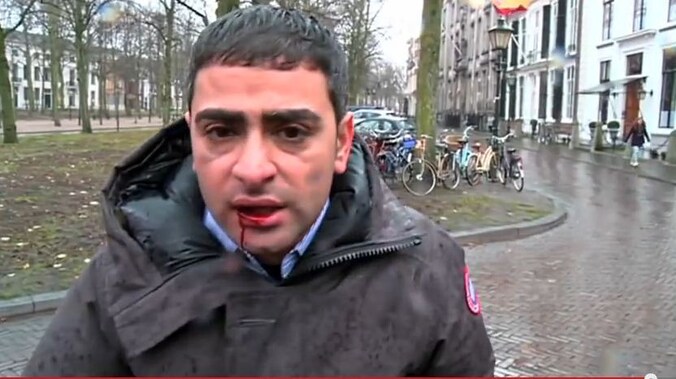 Verslaggever Danny Ghosen hield aan de mishandeling een losse tand, pijn in zijn kaak en een bloedende lip over.