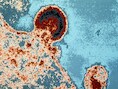 De techniek bestaat erin de reservoirs te ontmaskeren die het HIIV-virus in slapende immuuncellen vormt, waardoor ze naar het oppervlak van de cellen komt. Daar zou het natuurlijke immuunsysteem het virus kunnen elimineren.