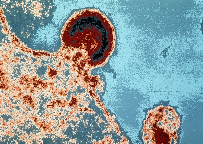 De techniek bestaat erin de reservoirs te ontmaskeren die het HIIV-virus in slapende immuuncellen vormt, waardoor ze naar het oppervlak van de cellen komt. Daar zou het natuurlijke immuunsysteem het virus kunnen elimineren.