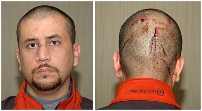 George Zimmerman