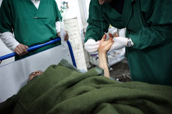 Artsen reinigen de hand van een man die gewond is geraakt door Kadhafi's raketten.