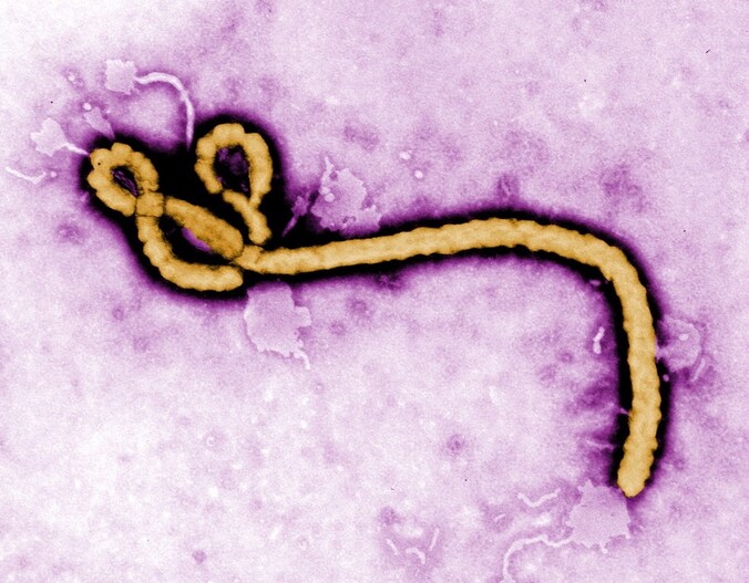 Het Ebolavirus.