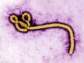 Het Ebolavirus.