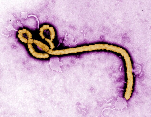 Het Ebolavirus.