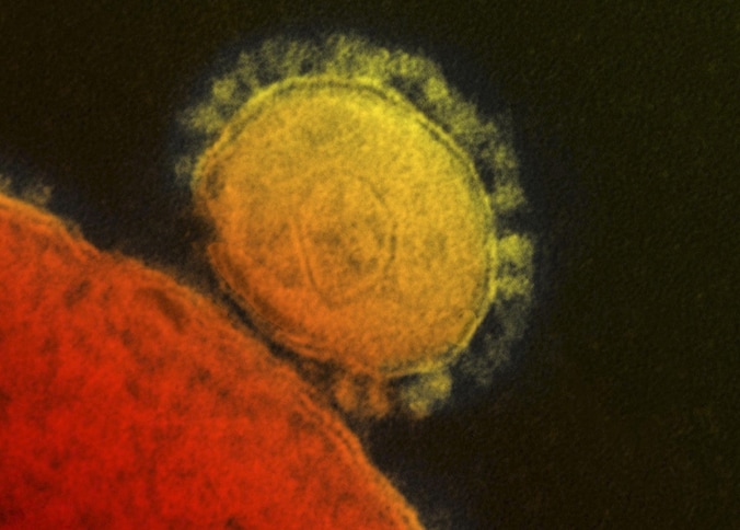 Een microscopische weergave van het MERS-virus, gepubliceerd door het Amerikaanse instituut voor infectieziekten.