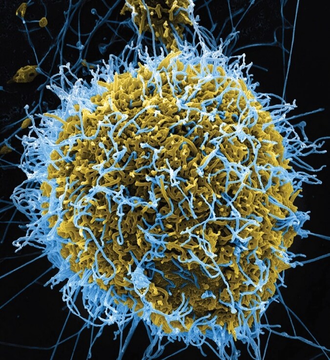 Scan van het ebolavirus uit een geïnfecteerde cel.