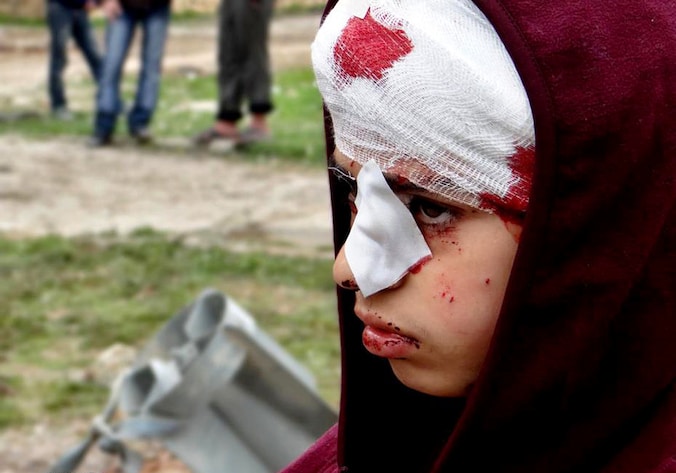 Er komt maar geen einde aan het bloedvergieten in Syrië.
