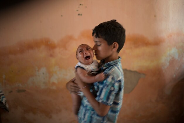 Het virus kan bij ongeboren baby's leiden tot microcefalie, een te kleine schedel met hersenschade tot gevolg.